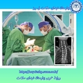 انجام موفقیت‌آمیز یک جراحی پیچیده و نادر اصلاح اسکولیوز شدید گردنی و قفسه سینه